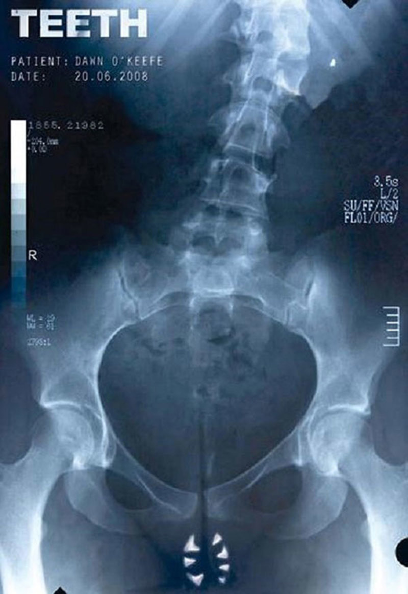 Medium 37eba1c153a128472fc8bbc2b51f6aa2 teeth 