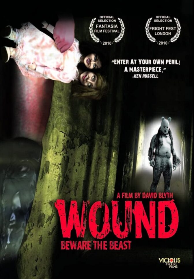 Wound