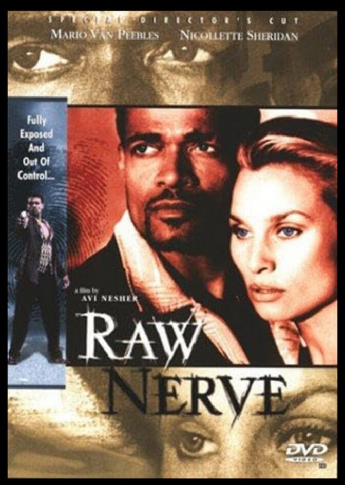 Raw Nerve